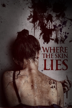 watch Where the Skin Lies movies free online